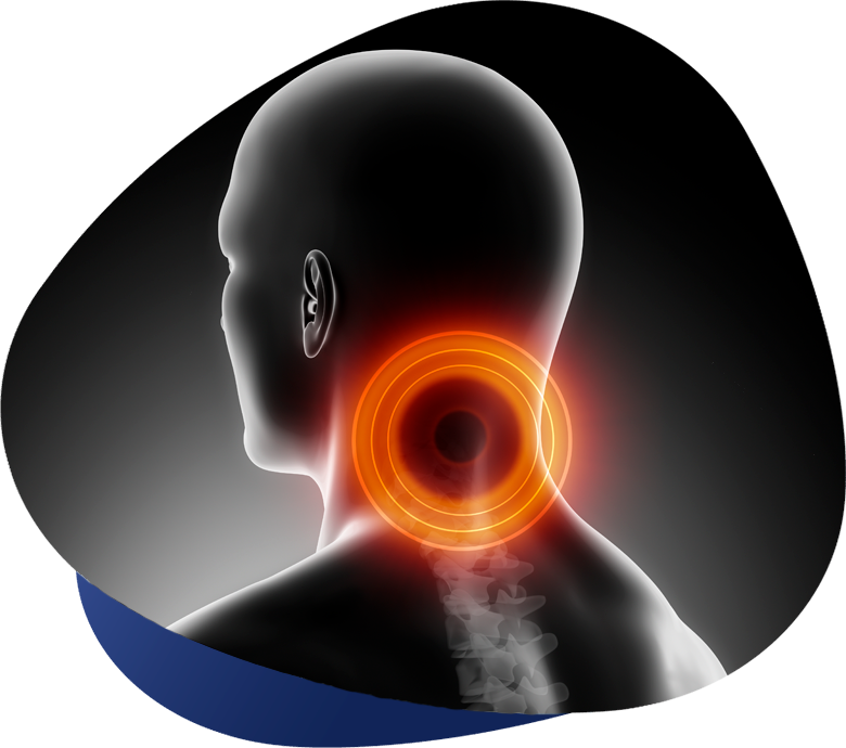 dolor-de-cuello