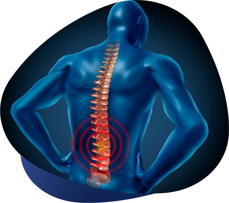 escoliosis
