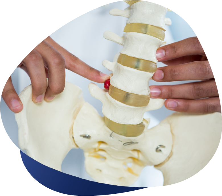 hernias-discales